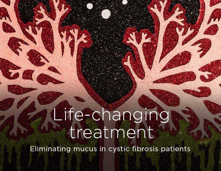 Life-changing treatment: Eliminating mucus in cystic fibrosis patients