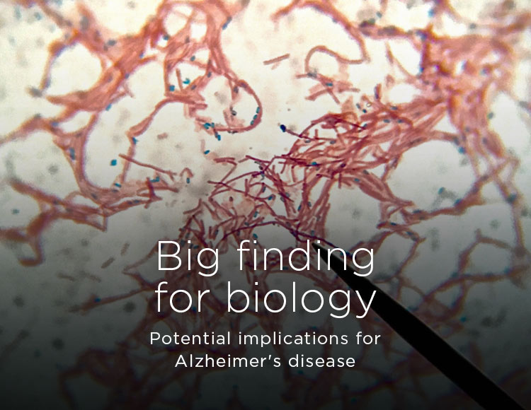 Big finding for biology: Potential implications for Alzheimer's disease