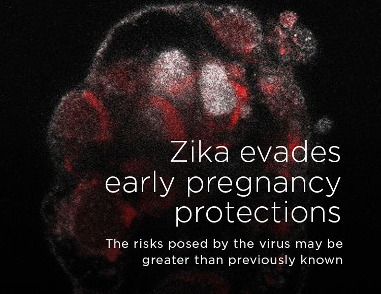 Zika evades early pregnancy protections: The risks posed by the virus may be greater than previously known