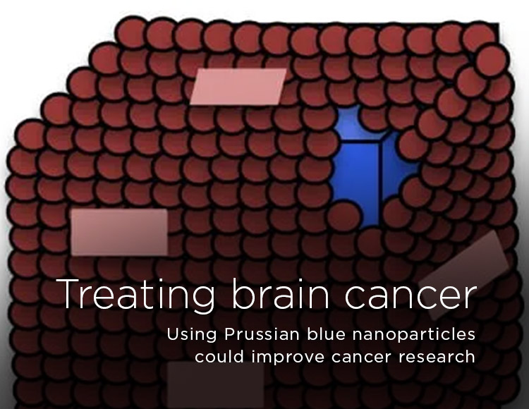 Treating brain cancer: Using Prussian blue nanoparticles could improve cancer research