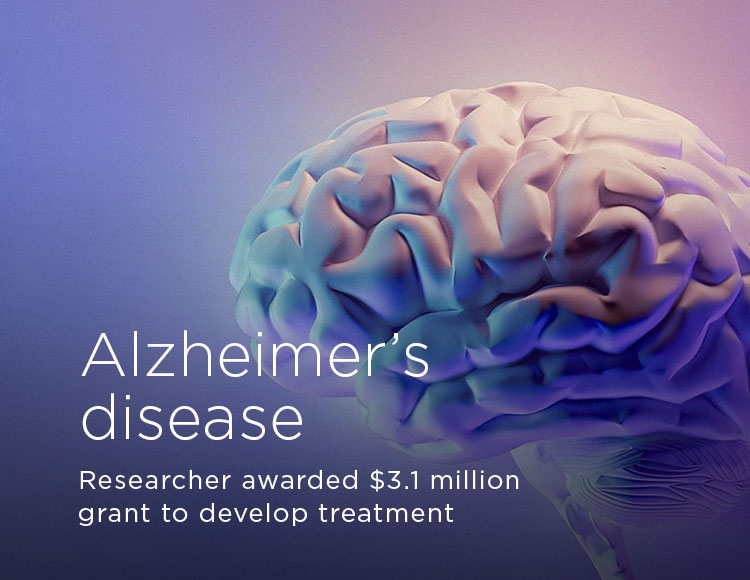 Alzheimer’s disease: Researcher awarded $3.1 million grant to develop treatment
