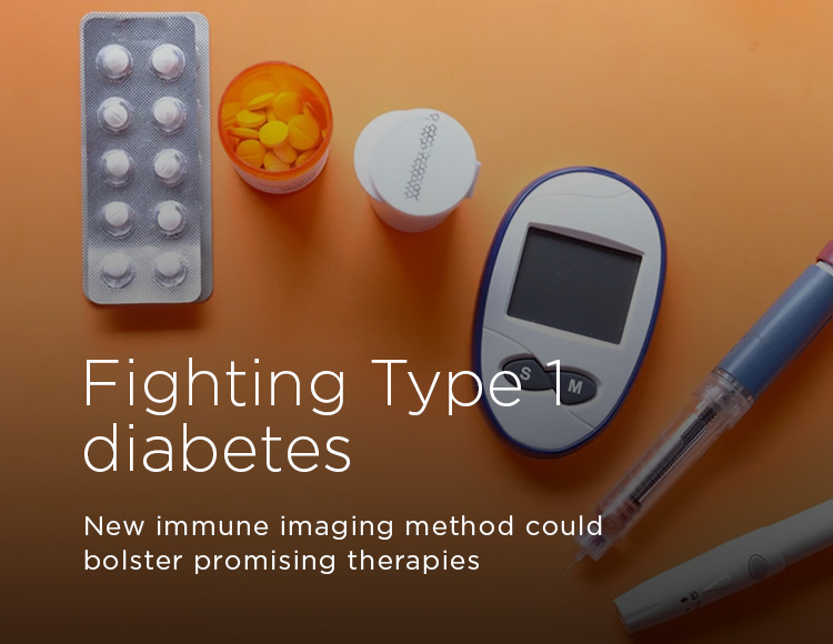 Fighting Type 1 diabetes: New immune imaging method could bolster promising therapies