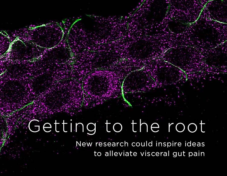 Getting to the root: New research could inspire ideas to alleviate visceral gut pain