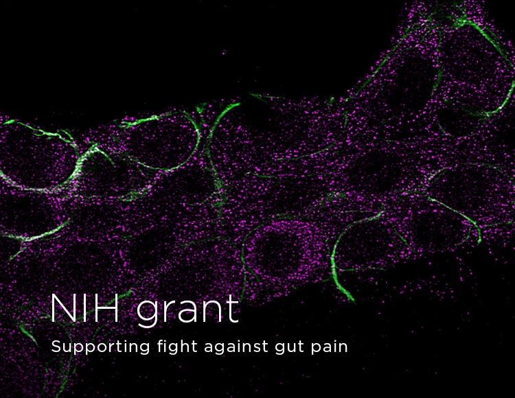 NIH grant: Supporting fight against gut pain
