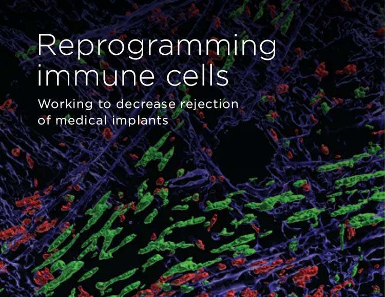 Reprogramming immune cells: Working to decrease rejection of medical implants